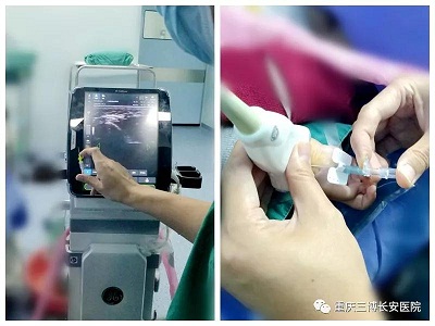 患兒小，麻醉管理難度大，成功挑戰(zhàn)院史小患兒的麻醉!