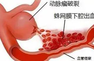 1536139162611319.jpg 微信圖片_20180905171823.jpg