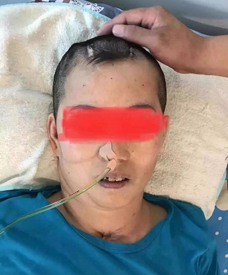 在家里如何長期護理昏迷患者？有哪些注意事項？