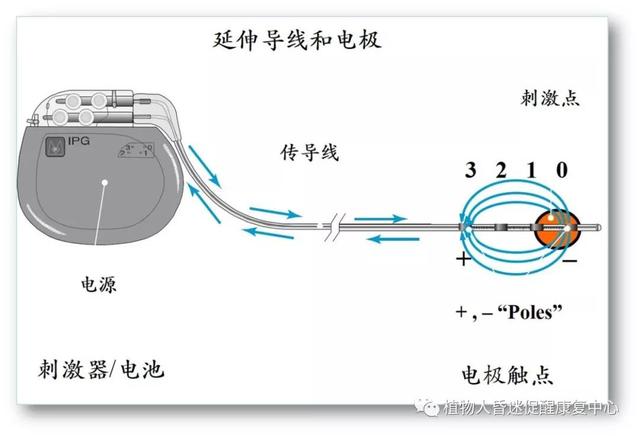 “植物人”真的無法醒過來嗎？這3種方法為昏迷促醒提供更多可能