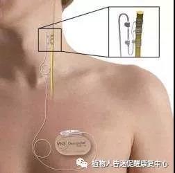 “植物人”真的無法醒過來嗎？這3種方法為昏迷促醒提供更多可能