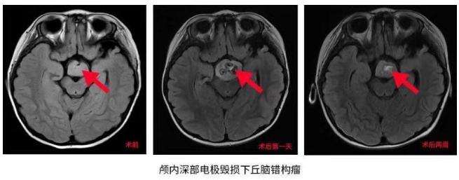 3歲女童愛笑性格好？她的“微笑”卻讓父母操碎了心