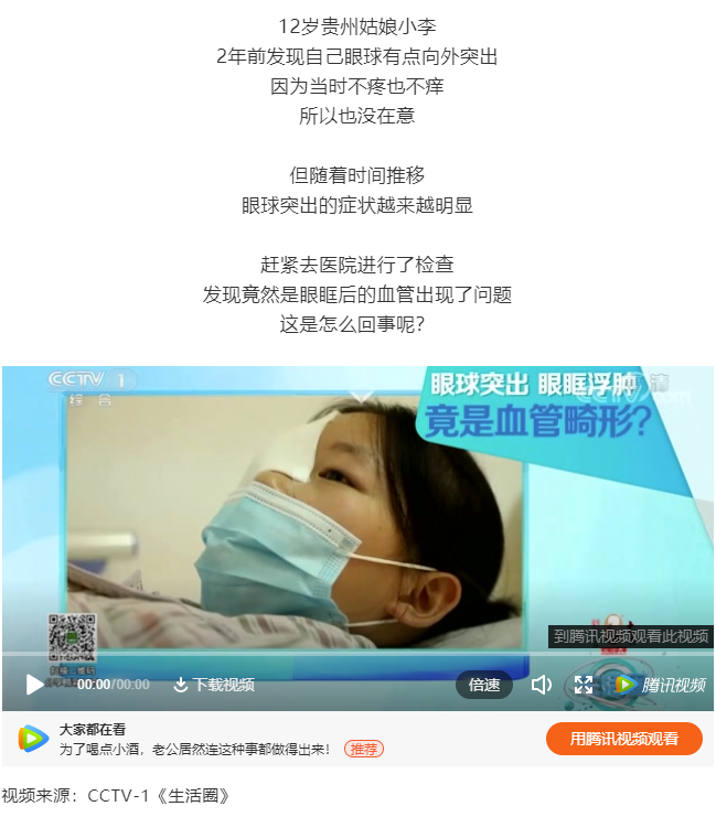 眼眶突出，眼球浮腫，竟是血管畸形！12歲貴州姑娘小李

2年前發(fā)現(xiàn)自己眼球有點向外突出

因為當時不疼也不癢

所以也沒在意



但隨著時間推移

眼球突出的癥狀越來越明顯



趕緊去醫(yī)院進行了檢查

發(fā)現(xiàn)竟然是眼眶后的血管出現(xiàn)了問題

這是怎么回事呢？